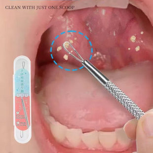 扁桃体结石去除工具取出隐窝神器口腔扁条体扁桃腺扁导体石清理器