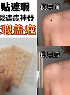 遮痣贴凹凸疤痕遮盖贴遮瑕贴黑痣脸部的超薄隐形贴神器痘痘贴