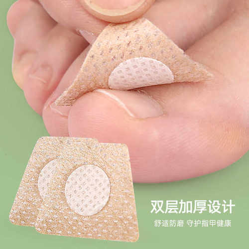 甲沟矫正器日本正甲贴嵌甲脚指甲
