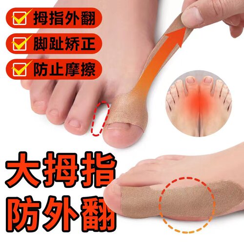 纠正脚趾神器拇指外翻分趾器大母足脚趾头大脚骨突出神器肌肉贴