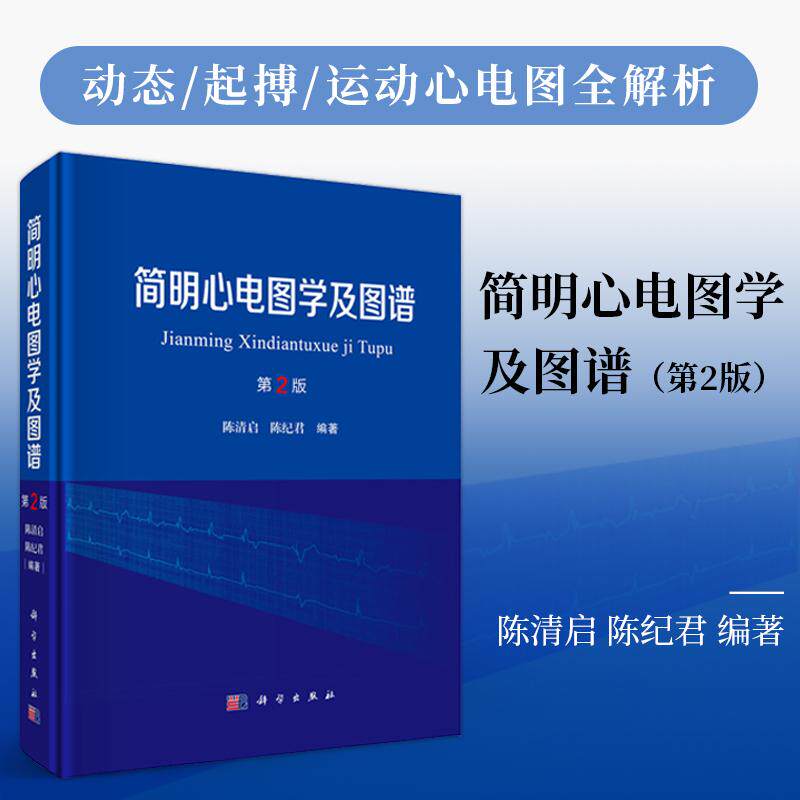 简明心电图学及图谱（第2版）