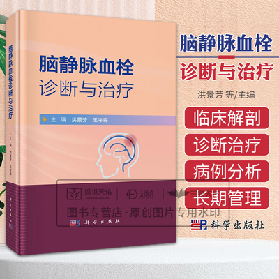 脑静脉血栓诊断与治疗 洪景芳等编 科学出版社 颅内静脉系统的临床解剖学 静脉窦血栓的直接切开取栓术 颈内静脉狭窄支架置入术