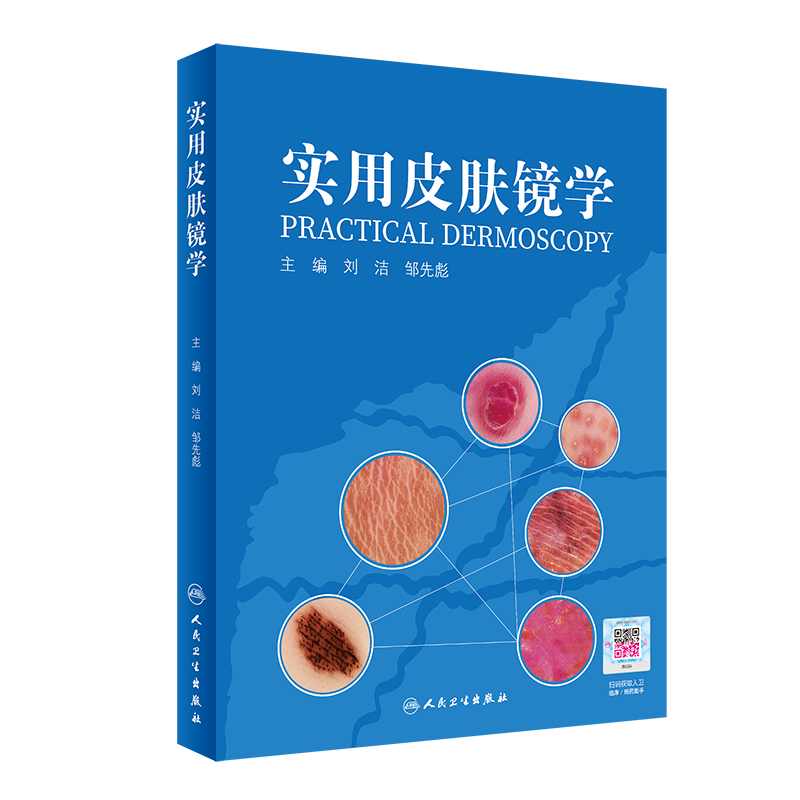 实用皮肤镜学 人卫刘洁邹先彪黑色素瘤脂溢性角化血管瘤银屑病黄褐斑协和皮肤镜图谱皮肤性病学人民卫生出版社皮肤科医学书