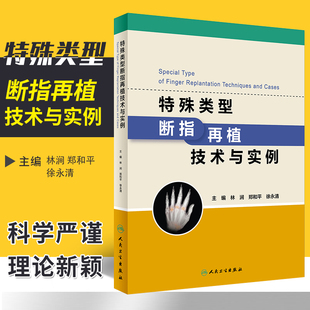 林涧等 手术要点等 人卫 本书内容分别为断指再植总论和着重介绍多种特殊类型断指再植概念病例介绍 特殊类型断指再植技术与实例