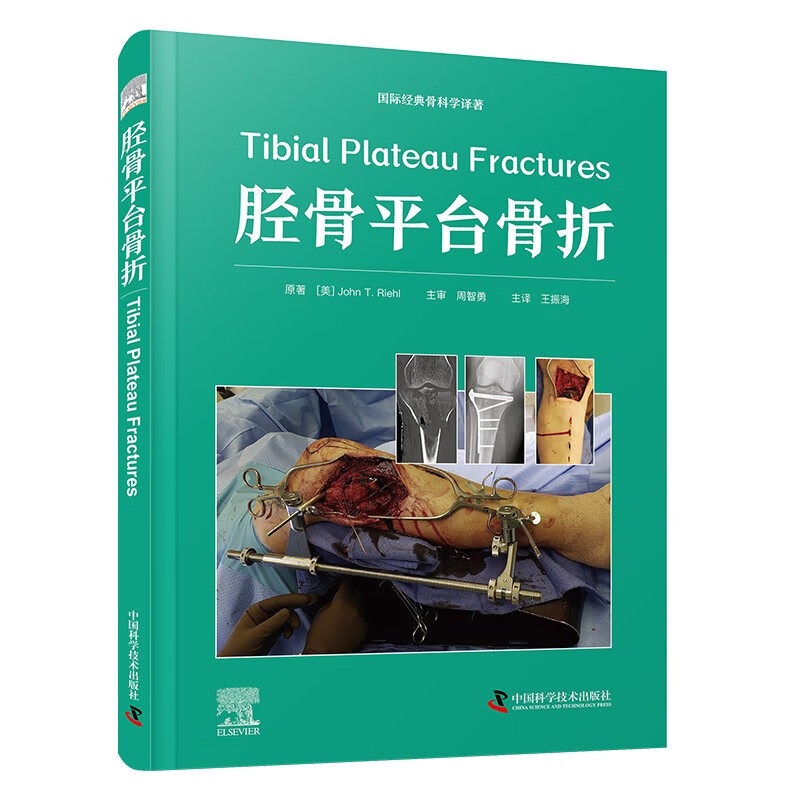 zgkj 胫骨平台骨折 国际经典骨科学译著 王振海主译 中国科学技术出版社 胫骨平台骨折的手术入路 伴随软组织损伤和并发症的治疗