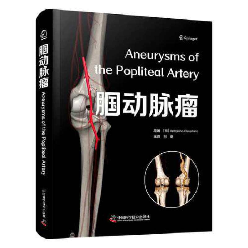 asy 腘动脉瘤 (意)安东尼诺·卡瓦拉罗|译者:刘勇 9787523610671 中国科学技术
