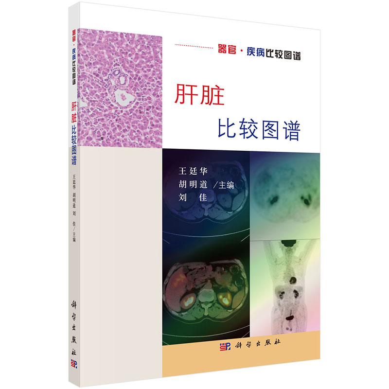 肝脏比较图谱 重点展示哺乳类动物从大鼠 树鼩到恒河猴再到人的肝脏解剖学 组织学及影像学信息 疾病比较图谱 廷华等编 科学