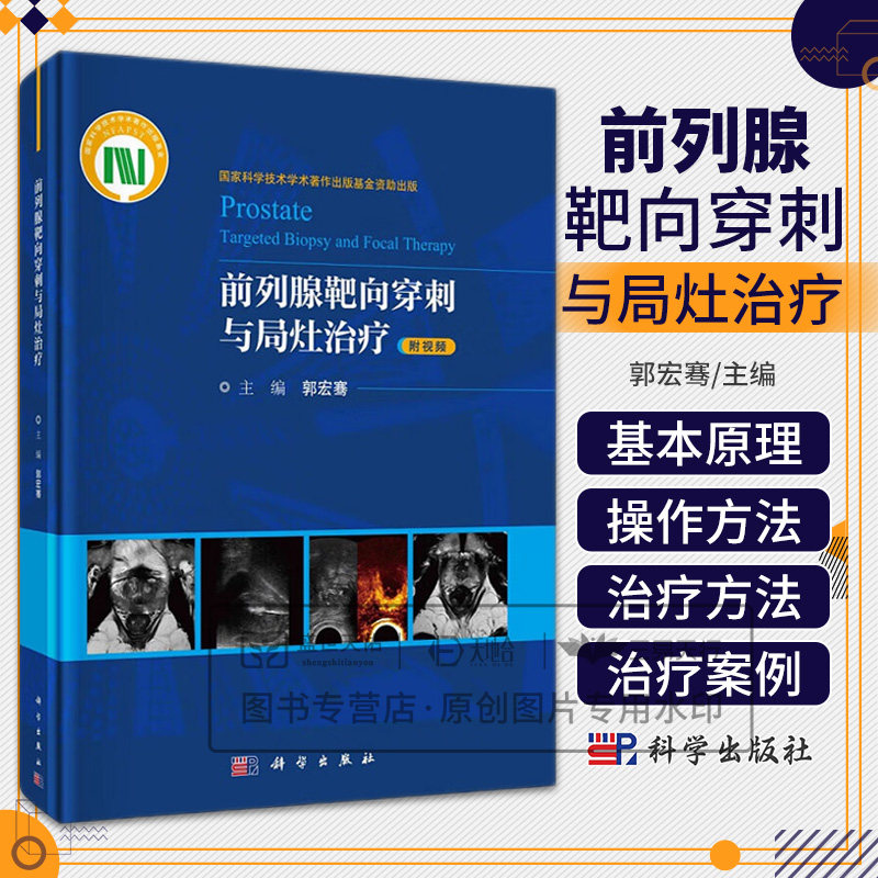前列腺靶向穿刺与局灶治疗 郭宏骞主编 科学出版社  科学技术学术著作出版基金资助出版 局灶消融策略的制定 光动力治疗