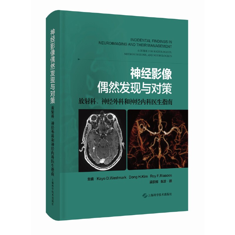 asy 神经影像偶然发现与对策:放射科、神经外科和神经内科医生指南