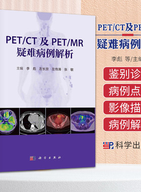 PETCT及PETMR疑难病例解析 李彪 科学出版社 病史简介 影像描述 病例讨论及病例点评 以肿瘤性病变为主 非肿瘤性病变疑难病例诊断