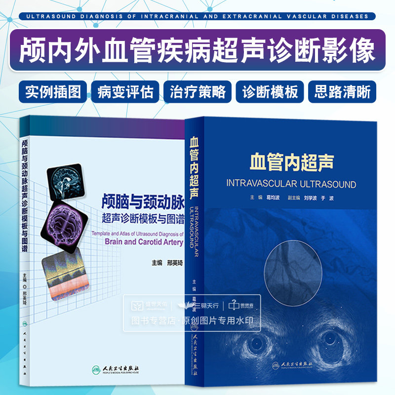 颅脑与颈动脉超声诊断模板与图谱+血管内超声 两本套 颅内外血管疾病的诊断模板及相应的典型病例 血管超声影像学 人民卫生出版社