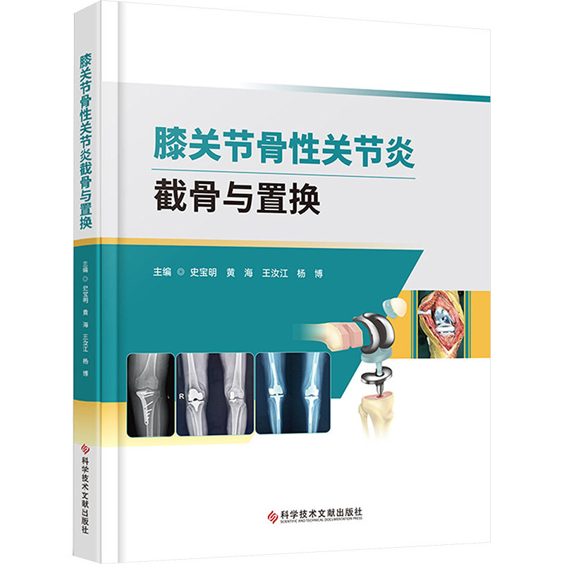 asy 膝关节骨性关节炎截骨与置换 史宝明 等 编 9787523517307 科学技术文献出版社