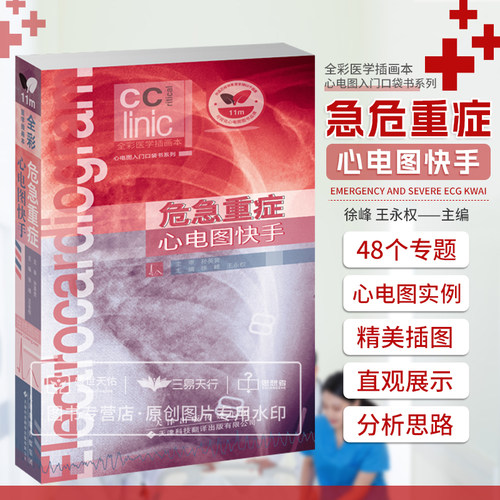 危急重症心电图快手 王永权等主编 轻度窦性心动过缓 折返性室上性心动过速 心室夺获和心室融合波 天津科技翻译出版公司