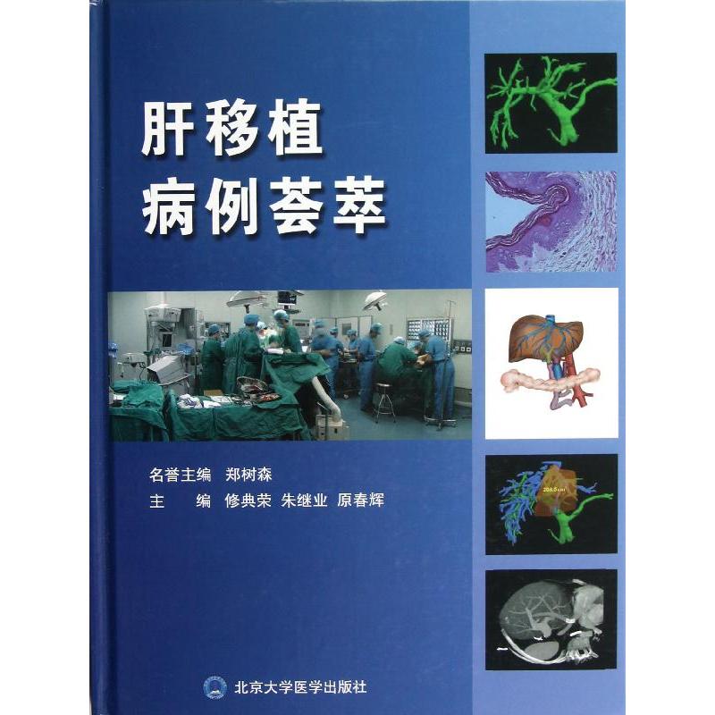 asy 肝移植病例荟萃 修典荣,朱继业,原春辉 编 著作 9787565903694 北京大学医学出版社