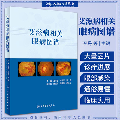 艾滋病相关眼病图谱 艾滋病眼病及相关的各类眼部并发症 合并症的临床诊治要点 大量临检图片 孙挥宇 毛菲菲 李丹 人民卫生出版社