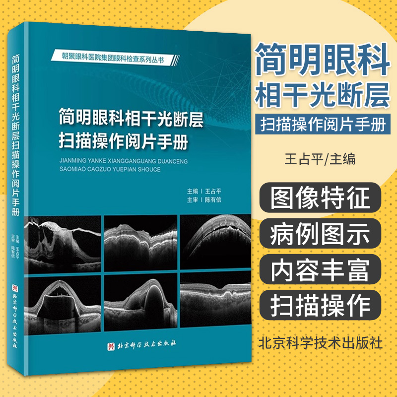 简明眼科相干光断层扫描操作阅片手册 王占平 北京科学技术出版社 朝聚眼科医院集团眼科检查系列丛书 眼科手册眼科医师用书