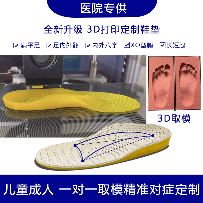 儿童成人3d打印定制扁平足外翻矫正鞋垫内八字脚X型腿矫正O型腿垫