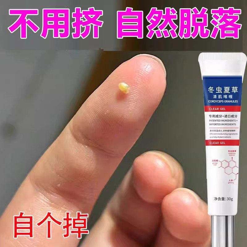 【黑科技】脂肪粒去除神器眼部眼角周油脂粒汗管粒专用清肌啫喱,美容护肤/美体/精油,眼部精华,淘宝优惠券,粉丝福利购,淘宝优惠卷