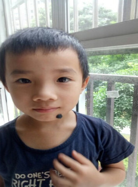 黑色泪痣伤疤化妆用硅胶假痦子瘊子假痣鼓的平的扮演媒婆伟人道具