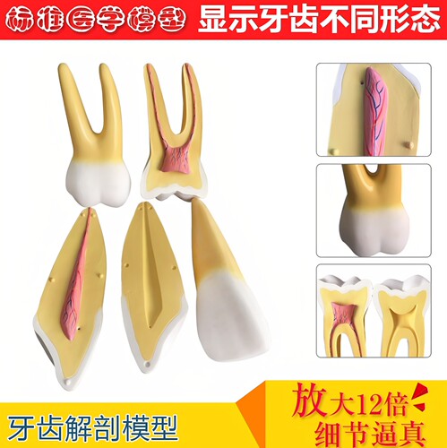 牙体解剖牙髓牙神经切牙尖磨模型