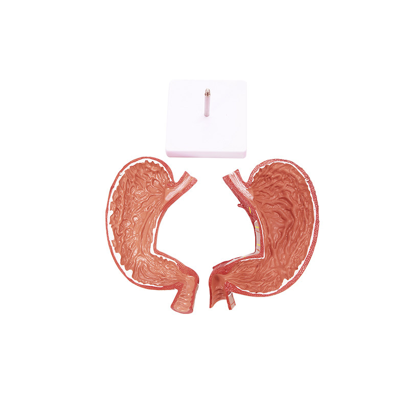 인체 위 해부학 모델 1.5 확대 이동식 2부분 의료 병원 학교 교육 설명 장식품