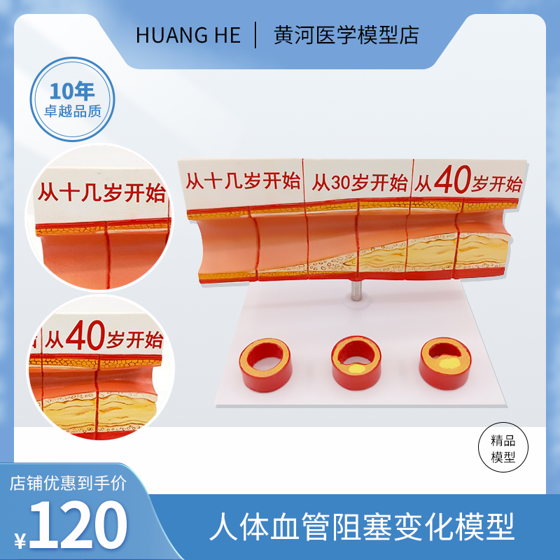 血管动脉阻塞变化演示层次器官