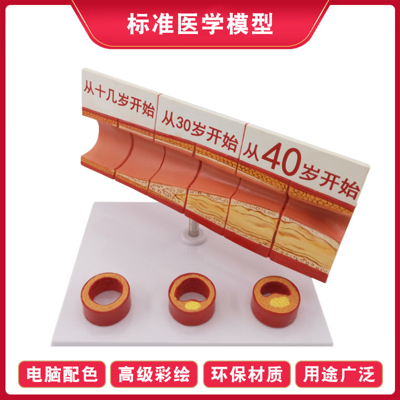인간 혈관 모델 동맥 혈관 방해 변경 데모 교육 모델 장기 해부학 구조 계층 모델