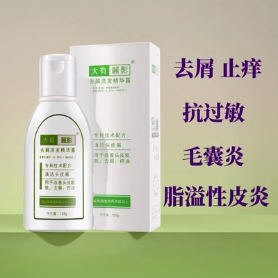 大有丽影去头屑洗发水止痒专业去大块头屑除螨虫二硫化硒抗过敏