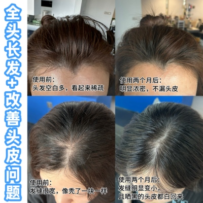 Kemon珂蒙赋活强效生发精华液