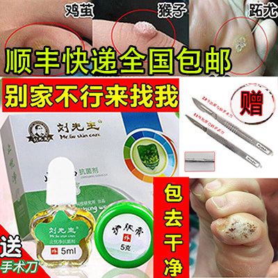 刘先生趾优净去除猴子刺猴肉猴鸡浴足剂