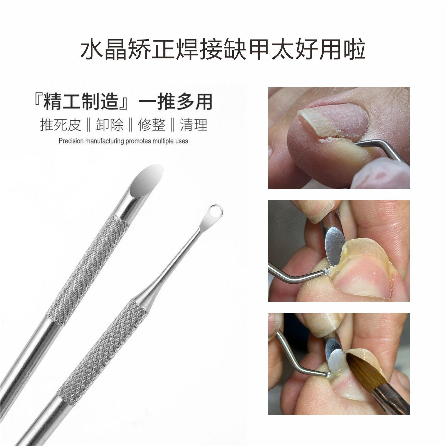 甲沟水晶矫正剔甲器嵌甲修脚工具