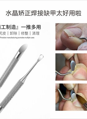 甲沟水晶矫正剔甲器嵌甲修脚工具
