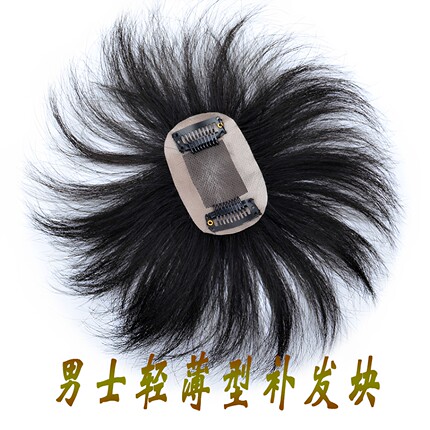 男士补发发块头顶秃顶无痕隐形发片前额脱发地中海谢顶真发假发片