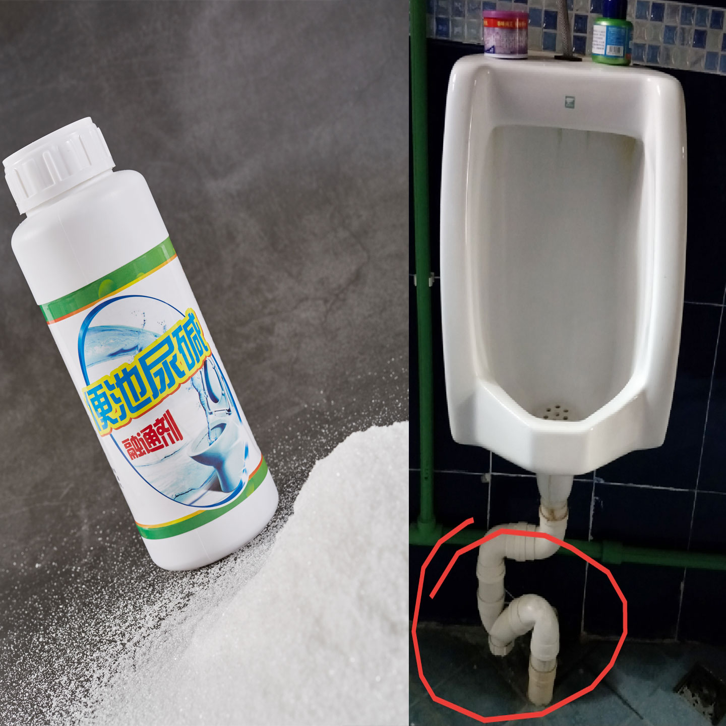 男生烟头毛发弯道黄垢尿碱溶解剂