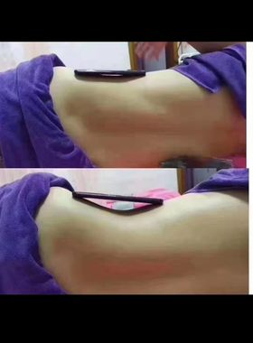 可以减肥可以培训瘦肚子瘦背瘦胳膊大腿去富贵包埋线针灸拔罐点穴