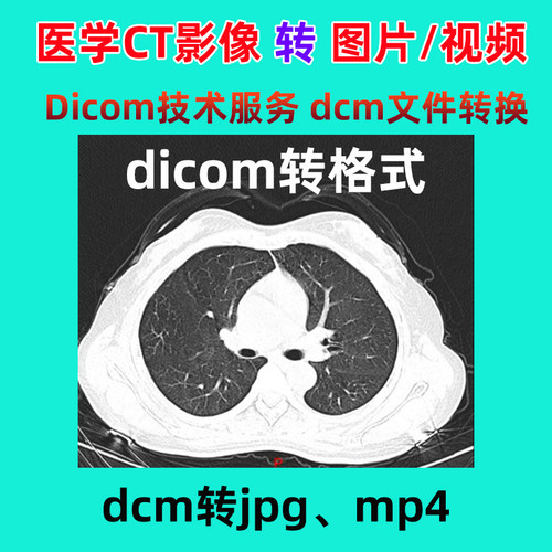 dicom影像CT转格式dcm转mp4视频dcm转图片云胶片格式转换jpg提取