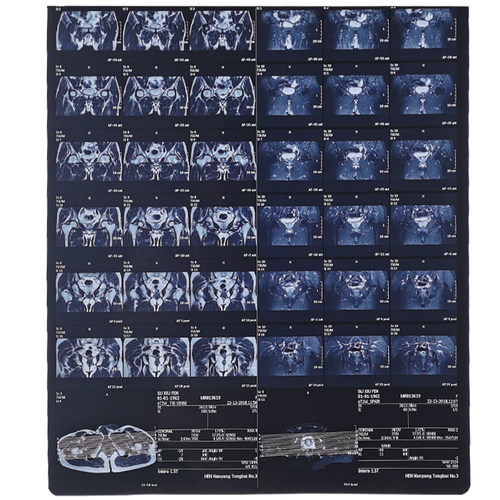 教学胶片影视道具胸片模型胶片