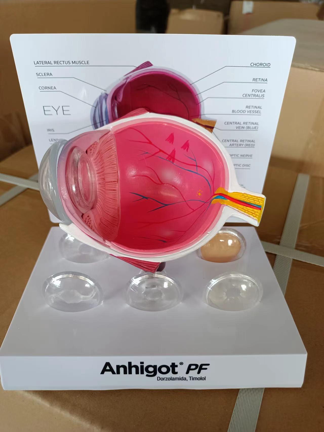 眼球解剖青光眼展示模型
