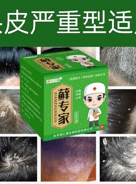 头藓毛囊发炎头部痒外用头皮真菌脂溢性大块头屑结痂止痒抑菌乳膏