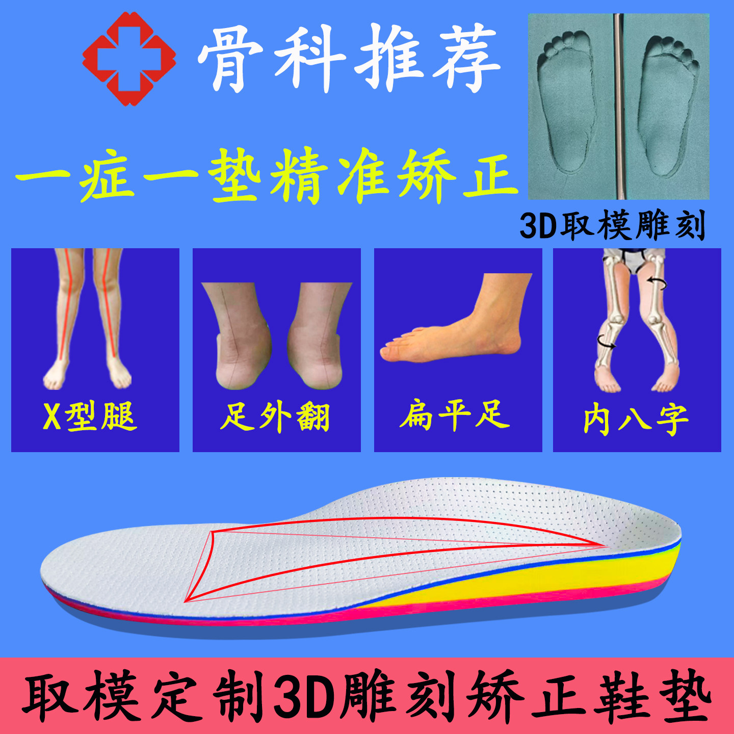 专用扁平足弓支撑XO型腿矫正鞋垫