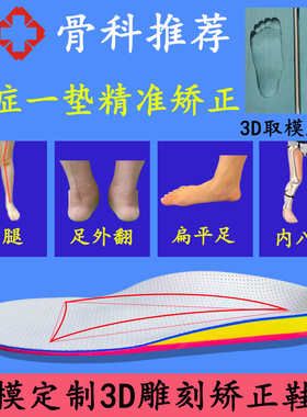专用扁平足弓支撑XO型腿矫正鞋垫