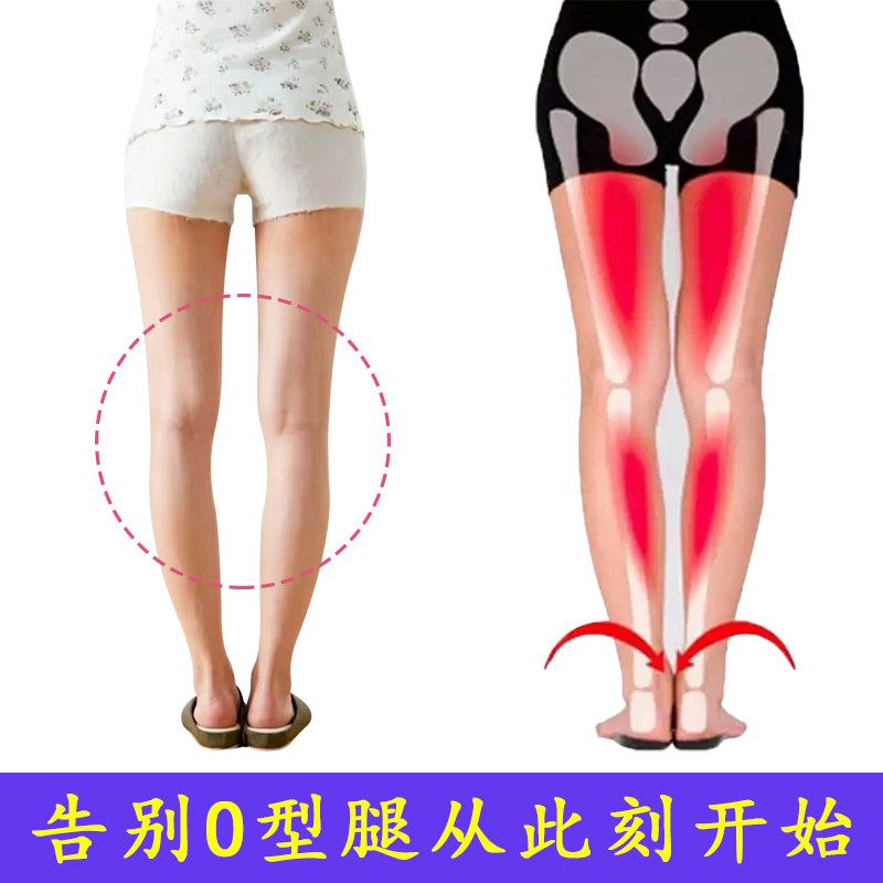 成人O型腿矫正鞋垫女式足内翻矫正器扁平足纠正鞋垫罗圈腿校正男