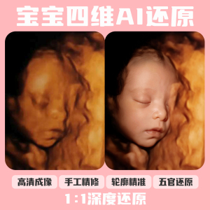 宝宝四维ai照片三维五维四维彩超还原预测胎儿长相高清婴儿成像