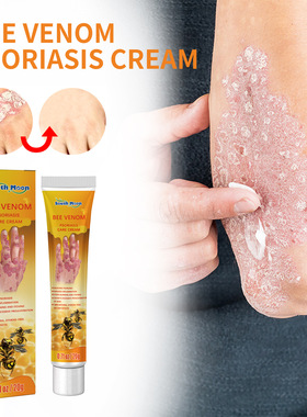 Skin Repair Cream Relieve Itchy Skin Repair Hand & Foot Moss