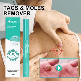 Repair and Cleansing Liquid Moles Deep Pen Skin Warts Smooth