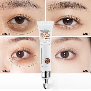 Collagen Dark Anti Wrinkle Cream Circles Peptide Eye