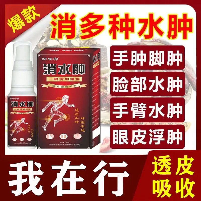 邹润安消水肿喷剂肿胀缓解肩膀手臂小腿关节久站水肿手脚浮肿正品