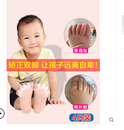 4只儿童大脚骨拇指外翻