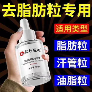 旗舰店 仁和匠心去脂肪粒眼部专用眼周用针油脂粒去除神器眼霜正品