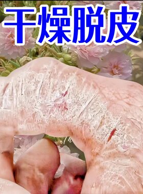 脚跟干裂滋润修护霜脚底皲裂脱皮